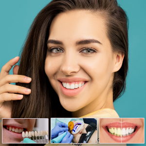 4 Treatments to Try With Cosmetic Dentist | Hudson | Hubbard
